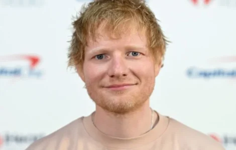 Ed Sheeran herpes zoster